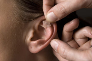 medico mette cerotto con semi di vaccaria su orecchio per auricoloterapia