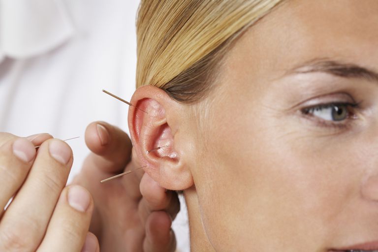 Quali punti di agopuntura orecchio per perdere peso